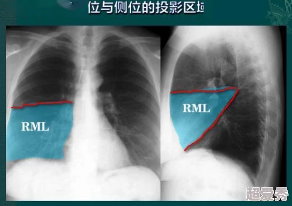 欧美亲胸揉胸膜下刺激免费视频网友认为这类视频内容过于露骨，影响青少年价值观，应加强监管与引导