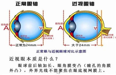 高h各种姿势1v1网友认为这种题材虽然吸引眼球但过于露骨，可能影响青少年的价值观和审美观，呼吁适度创作