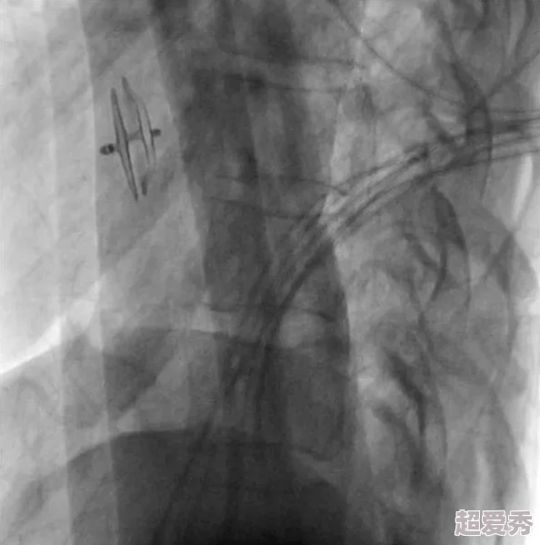 日死你开发团队表示游戏已进入最终测试阶段预计下个月上线