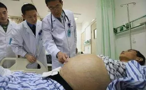 腹痛病美男吧小腹隆起检查结果出来了，医生说是胀气，虚惊一场